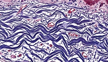 Коллаген и его виды